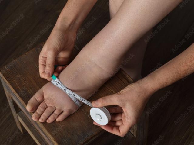 Bas de compression veineuse sur-mesure : Chaussettes, bas et collants sur-mesure